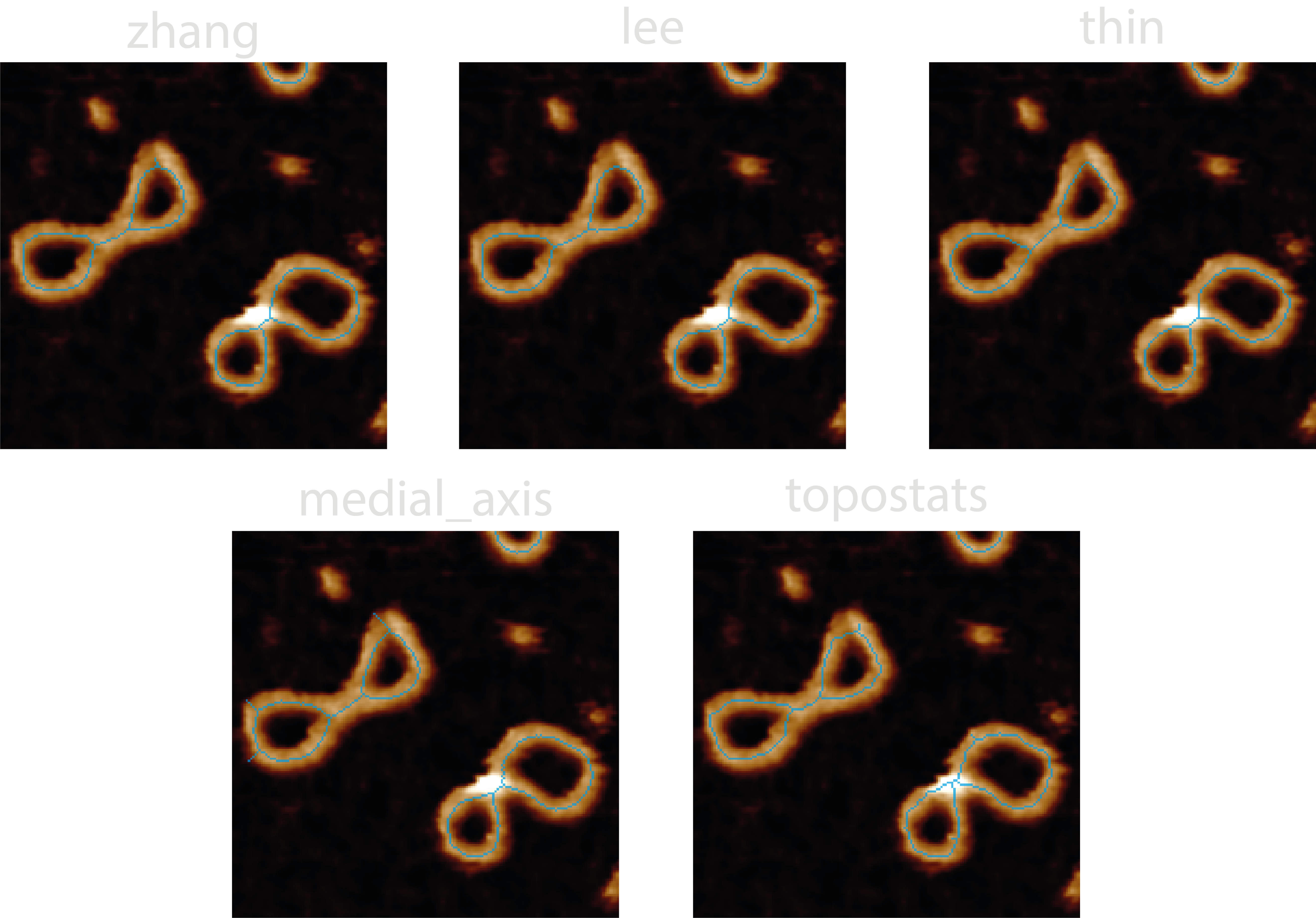 Comparison between skeletonisation algorithms